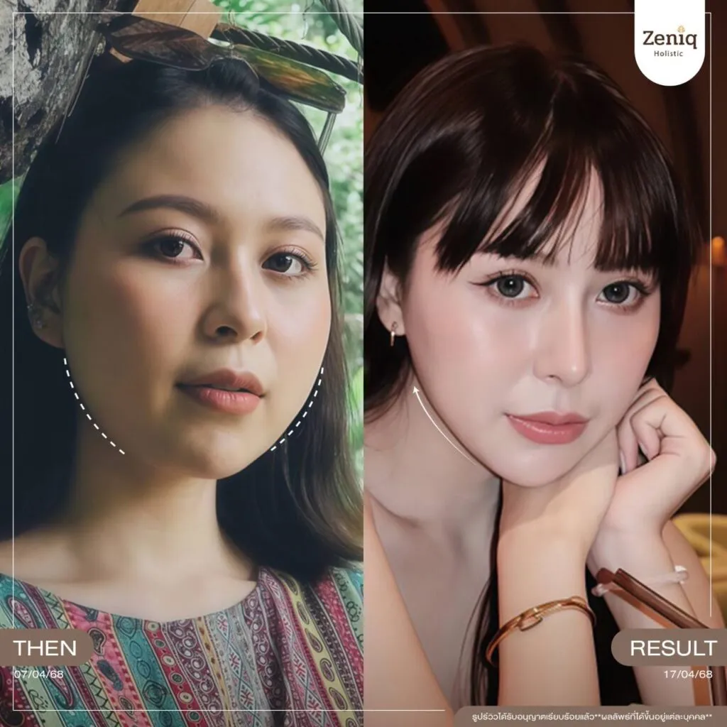 review Zeniq Holistic before after google review