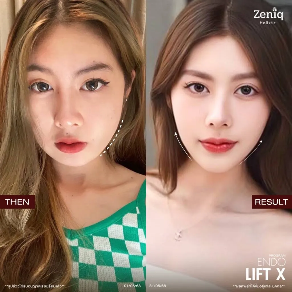 review Zeniq Holistic before after google review