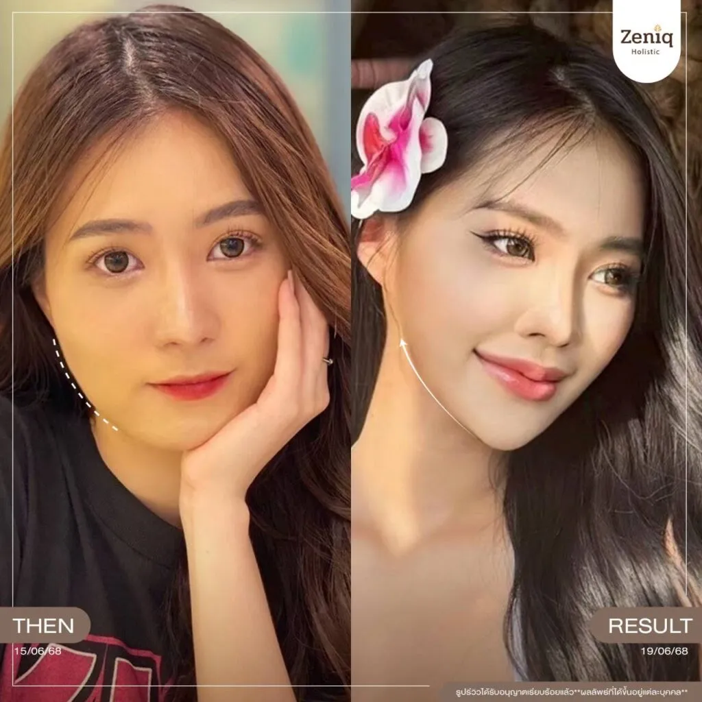 review Zeniq Holistic before after google review