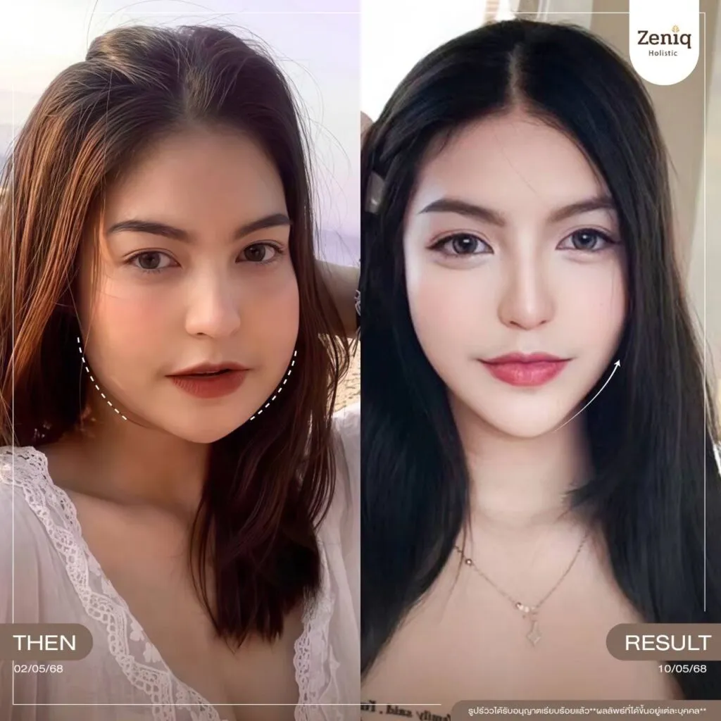 review Zeniq Holistic before after google review