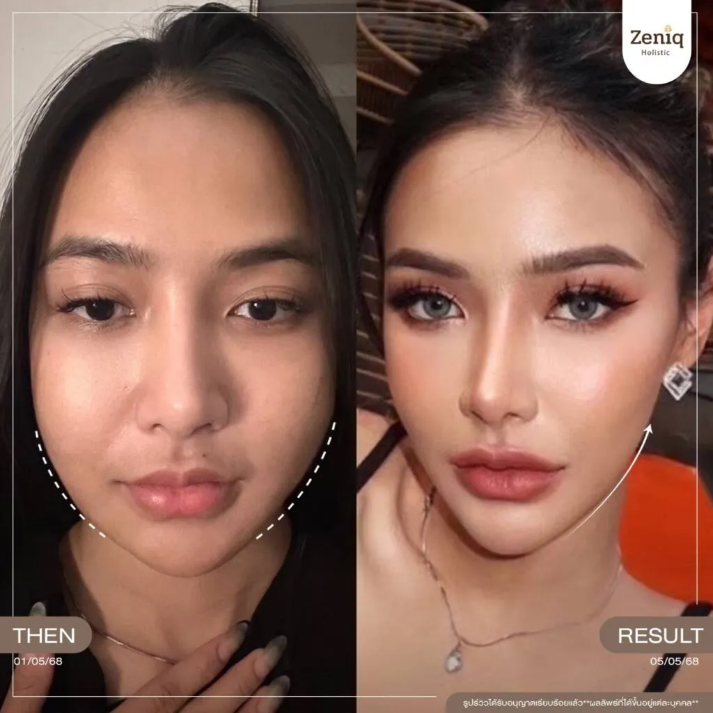 review Zeniq Holistic before after google review