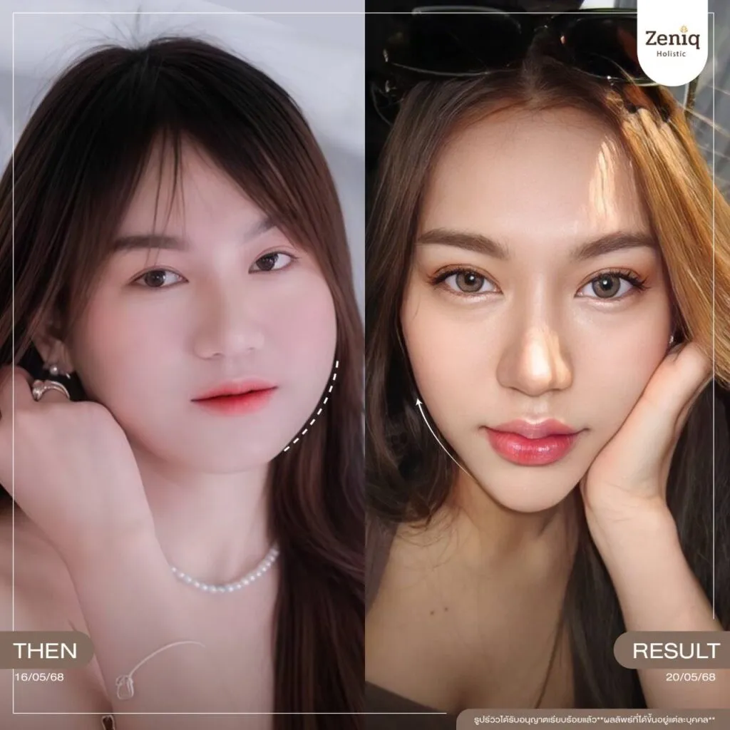 review Zeniq Holistic before after google review