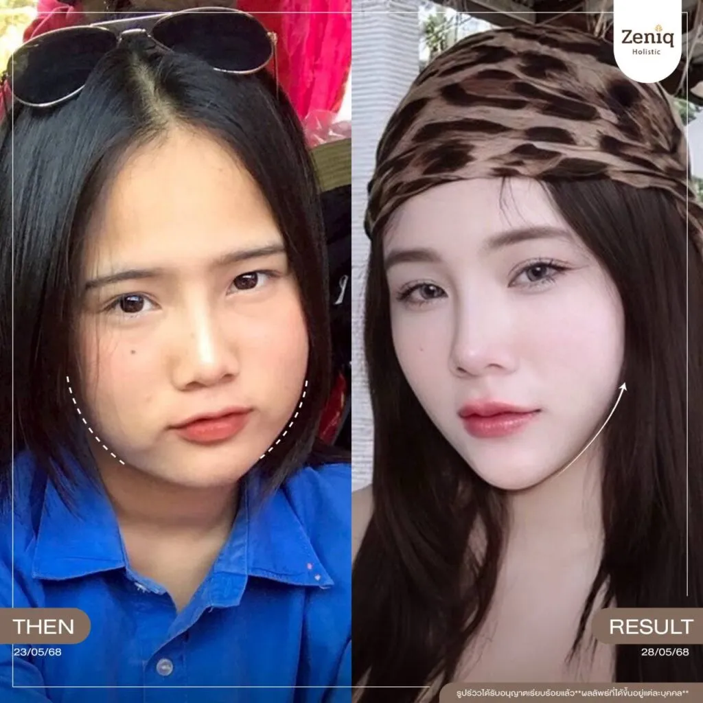 review Zeniq Holistic before after google review