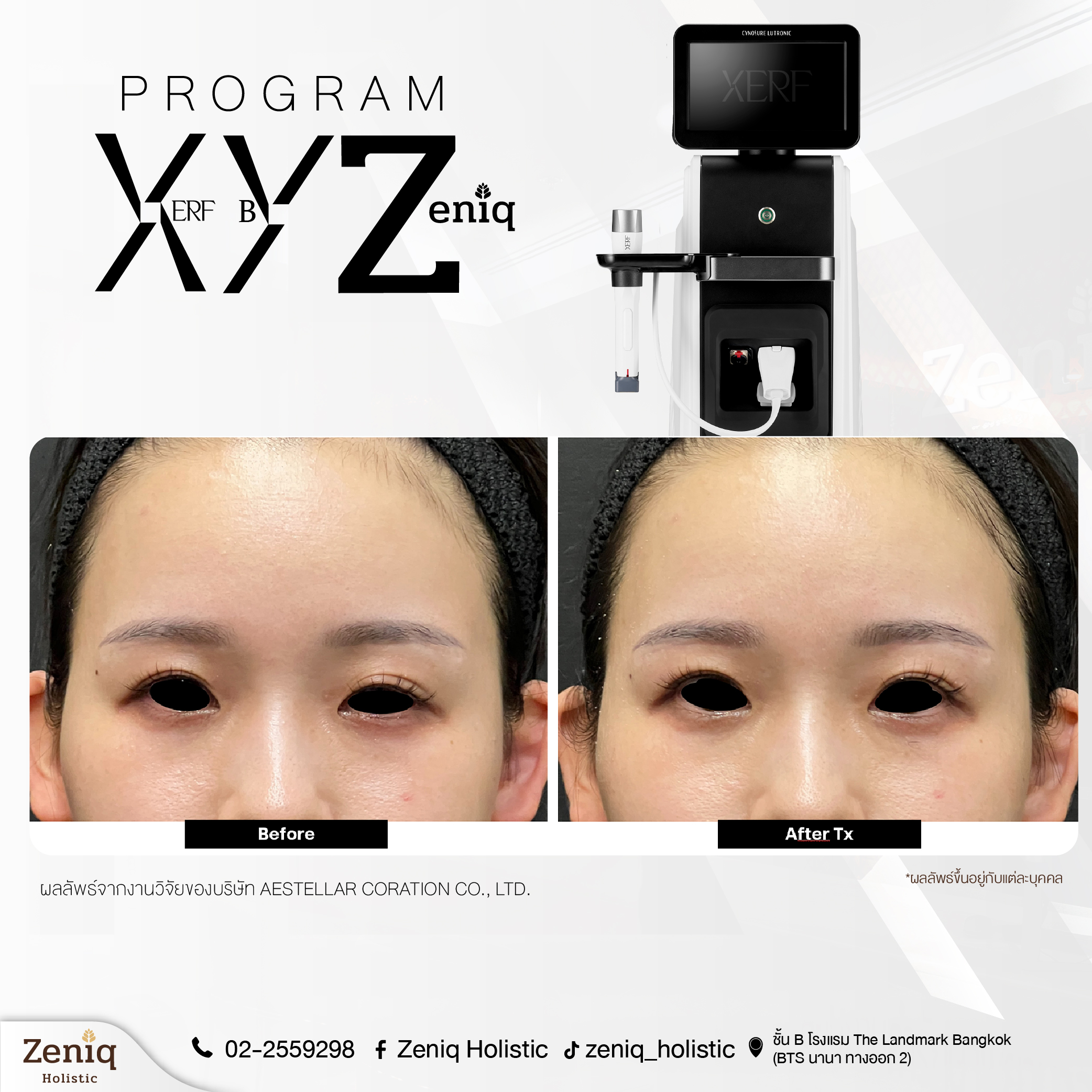 Zeniq Holistic review